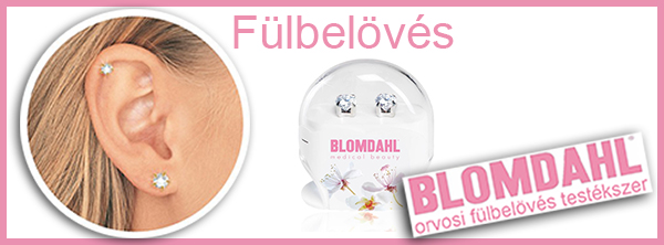 Fülbelövés Vecsés